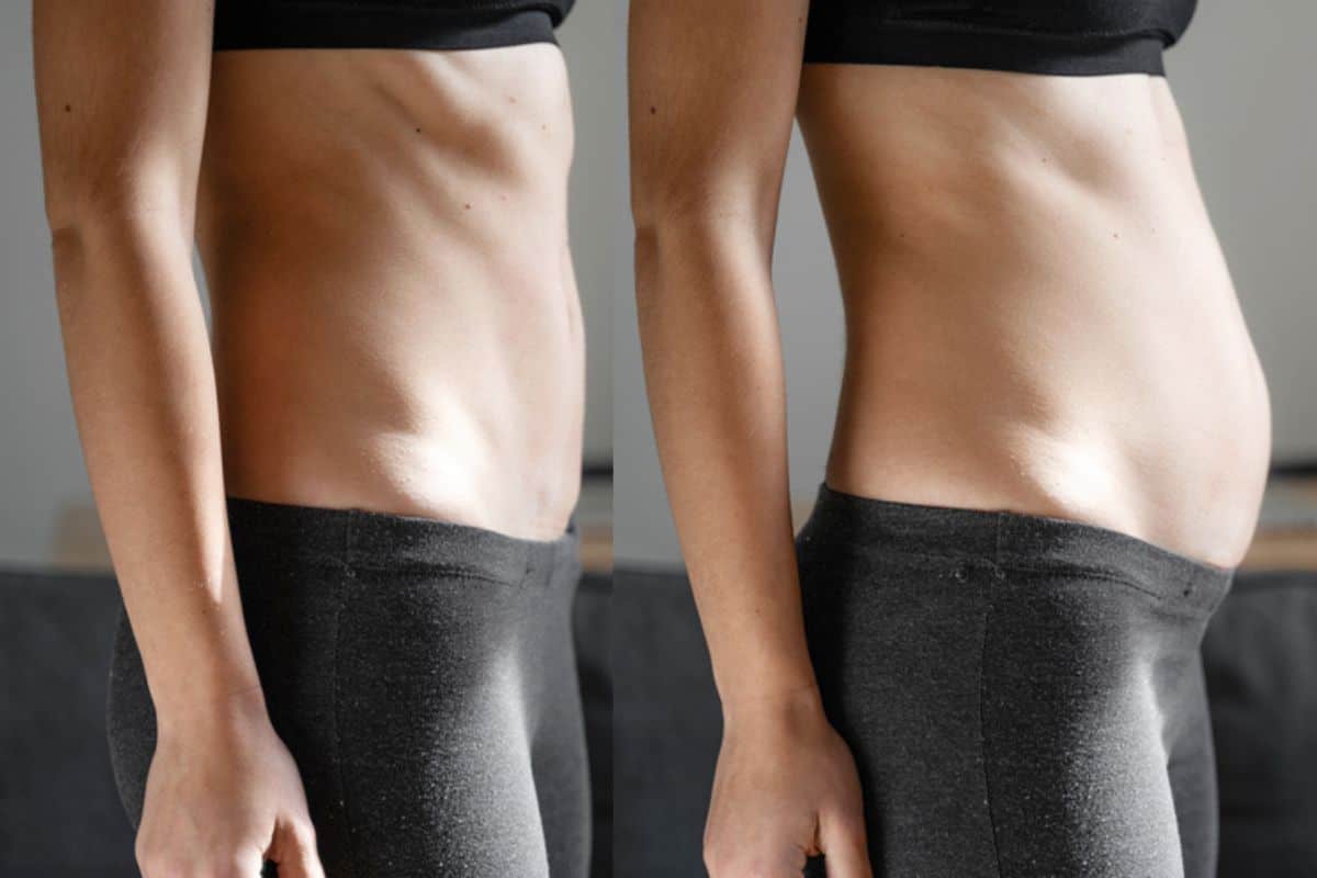 How long does diastasis recti take to improve Derbyshire?
