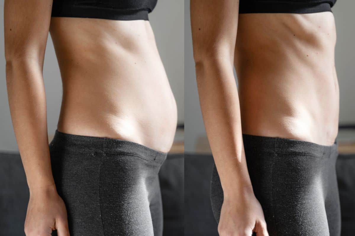 Post-Pregnancy: What Happens to Your Abdominal Muscles After Birth Derbyshire