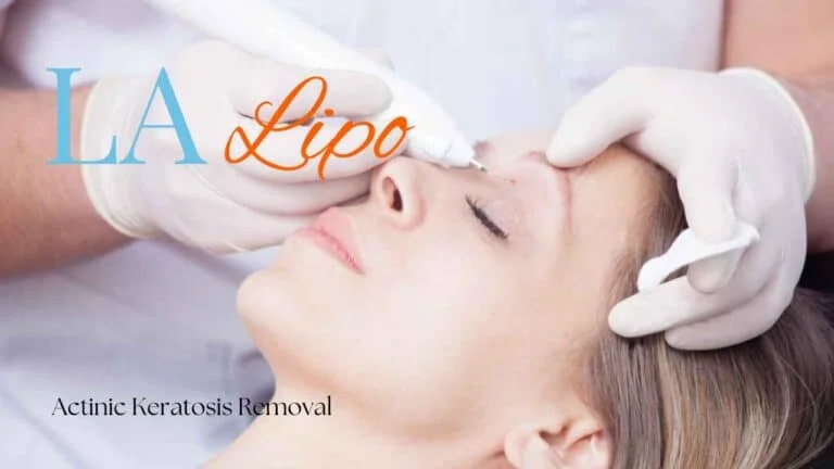 Woman receiving Actinic Keratosis Removal Treatment Derbyshire