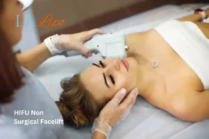 Woman having Hi-Fu to reduce wrinkles Derbyshire.
