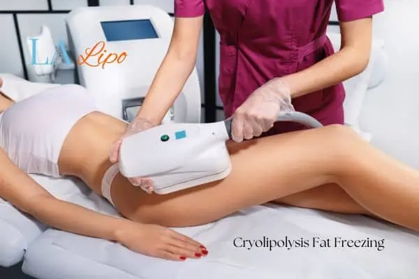 Woman receiving coolsculpting Derbyshire treatment on her thighs