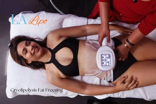 woman getting cryolipolysis Derbyshire