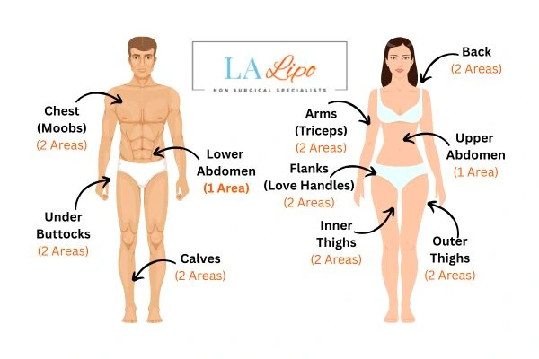 LA LIPO Cryolipolysis Areas Derbyshire