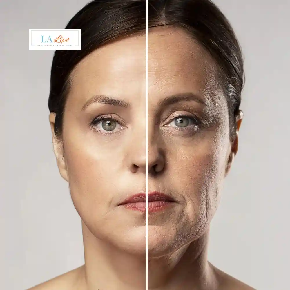 How Can You Tell If Non-Surgical Skin Tightening Is Right for You Derbyshire?