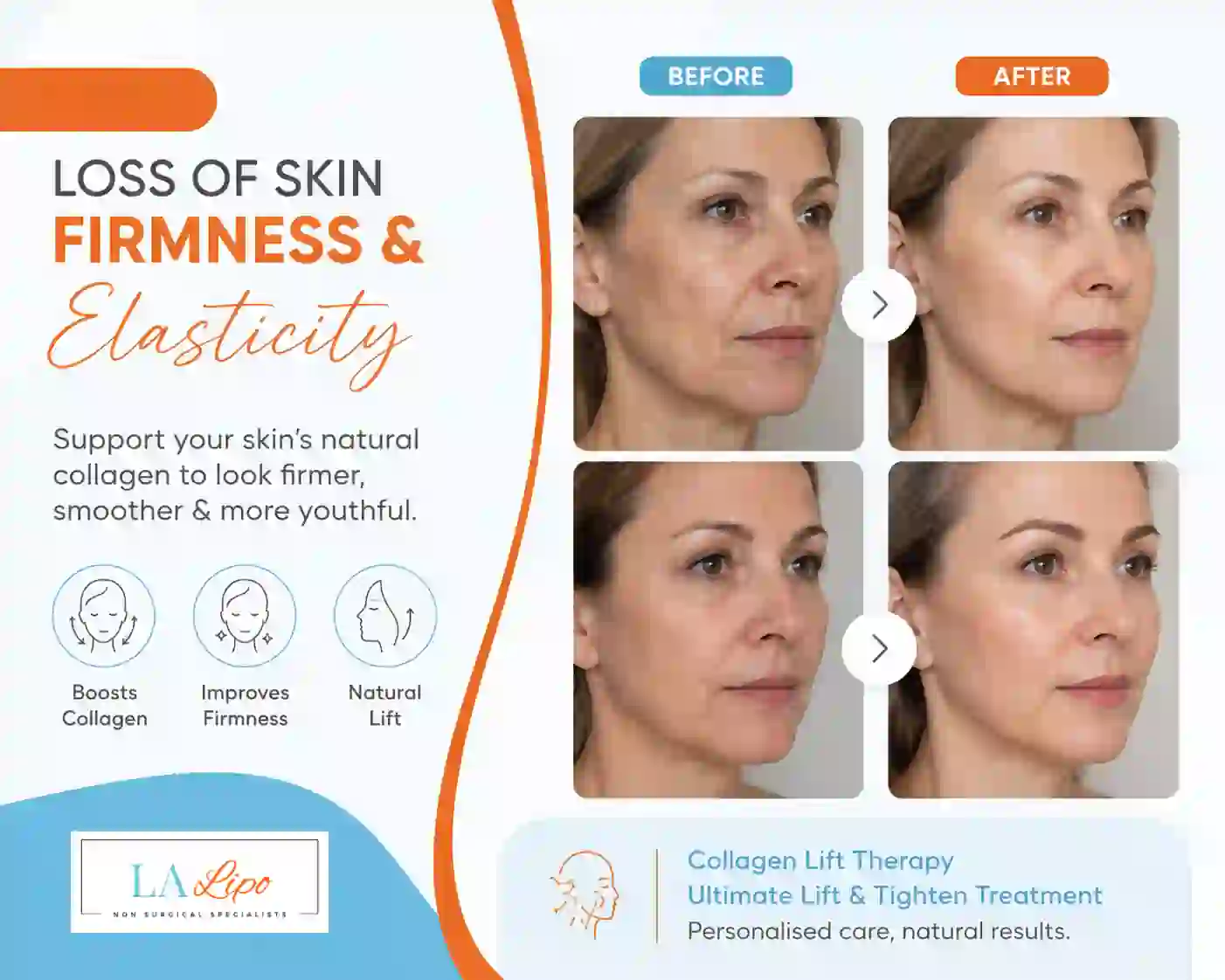 Sign #7: Loss of Skin Firmness and Elasticity Derbyshire