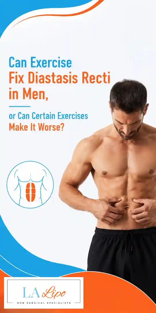 Can Exercise Fix Diastasis Recti in Men, or Can Certain Exercises Make It Worse Derbyshire?